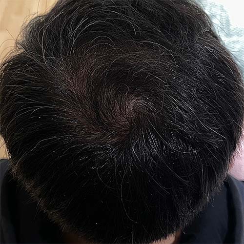 After