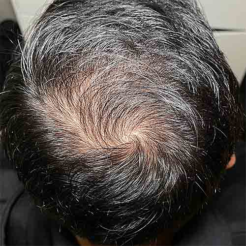 Before